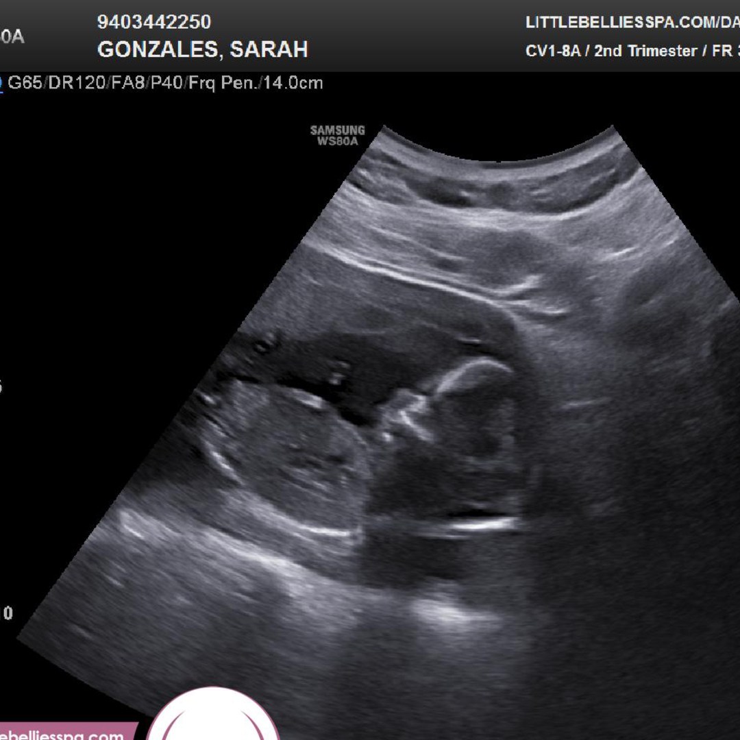 Photo shared by Sarah for their Babylist baby registry.