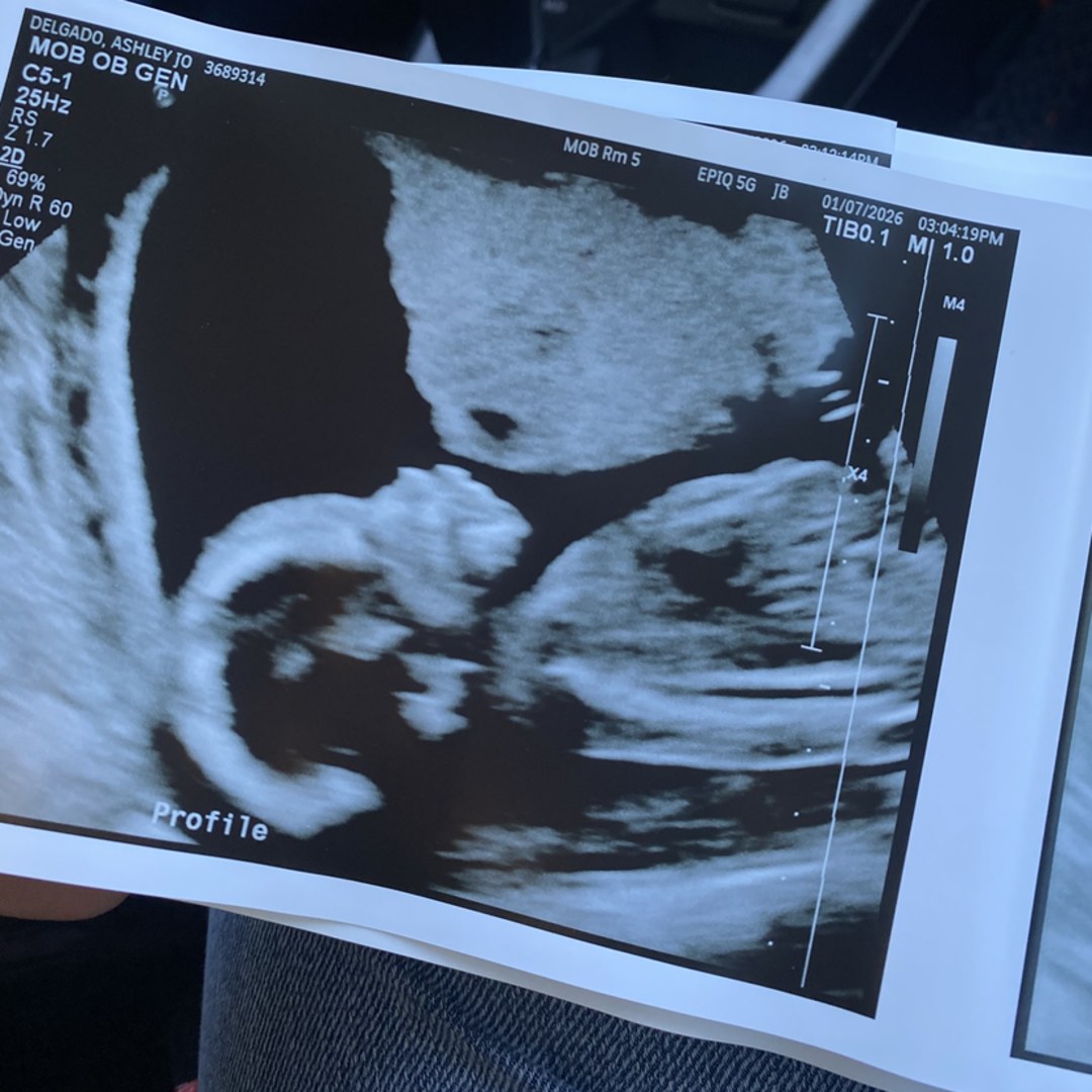 Photo shared by Ashley for their Babylist baby registry.