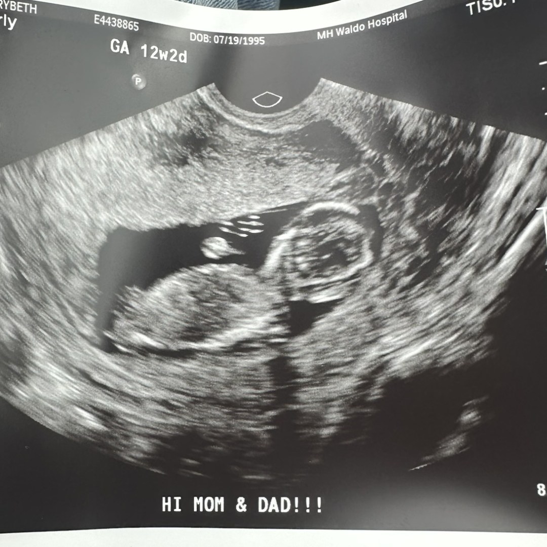 Photo shared by Marybeth for their Babylist baby registry.