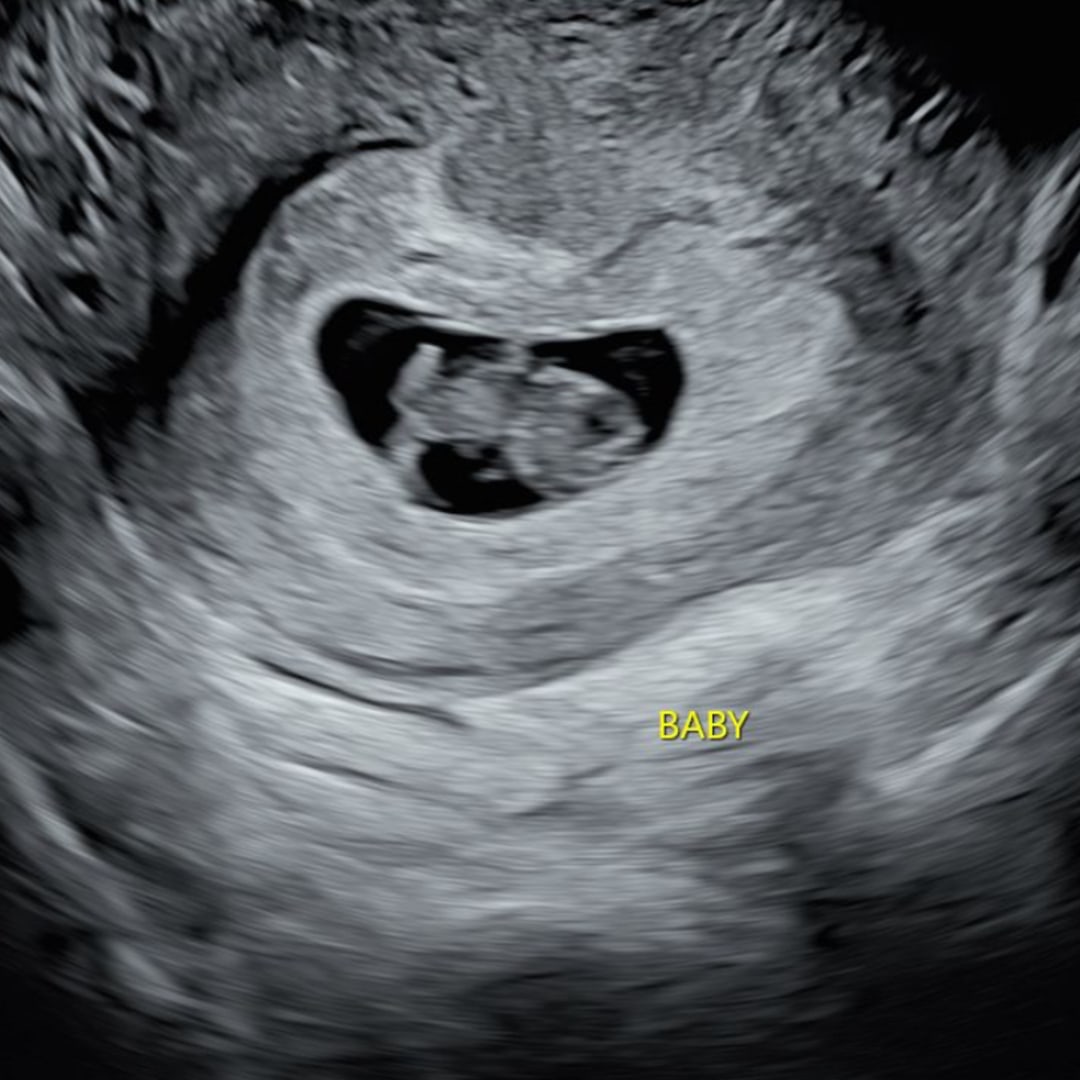 Photo shared by Haley for their Babylist baby registry.