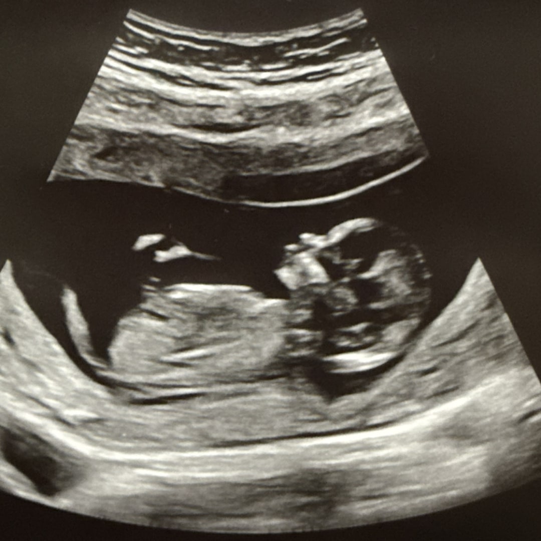 Photo shared by Kay for their Babylist baby registry.