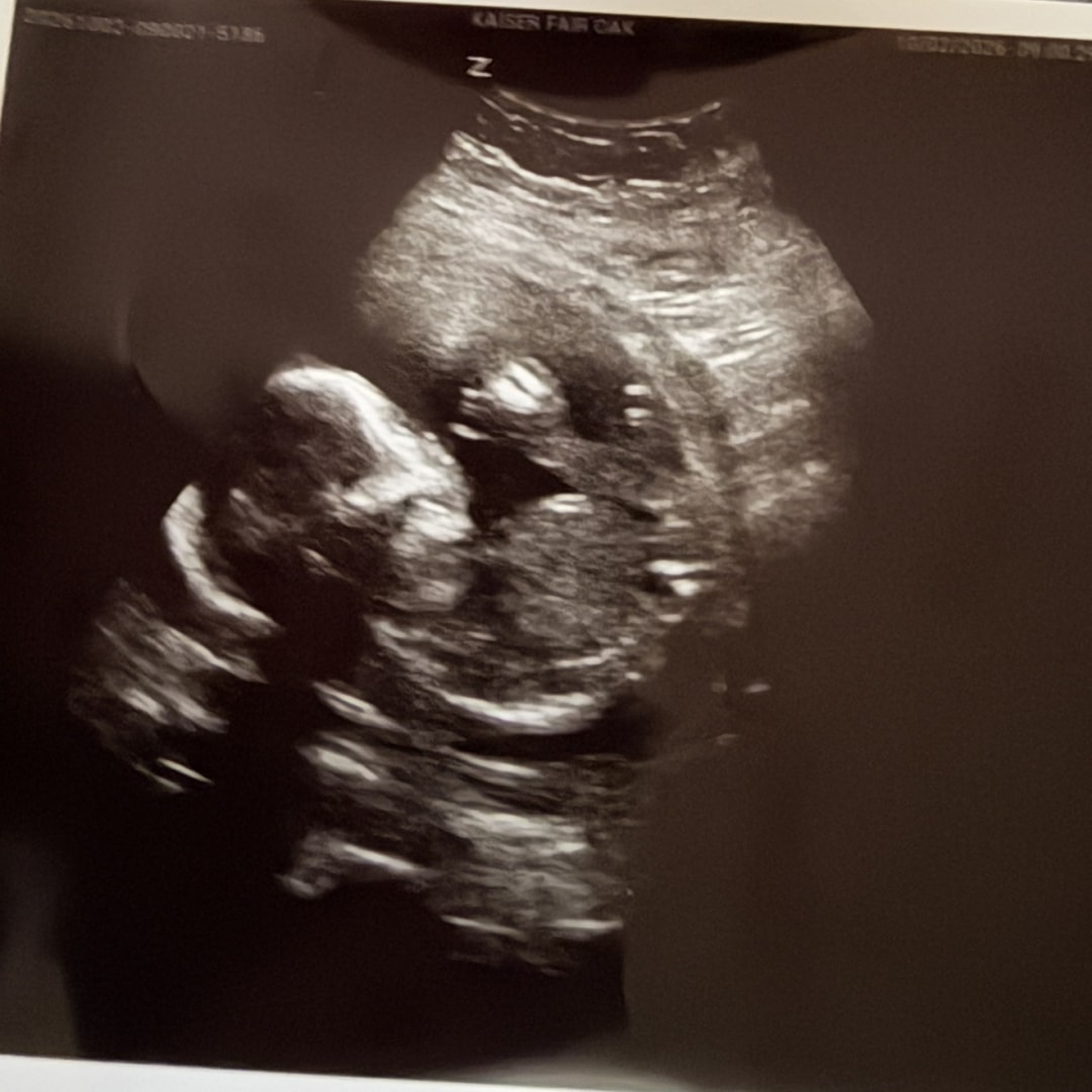 Photo shared by Lexi for their Babylist baby registry.