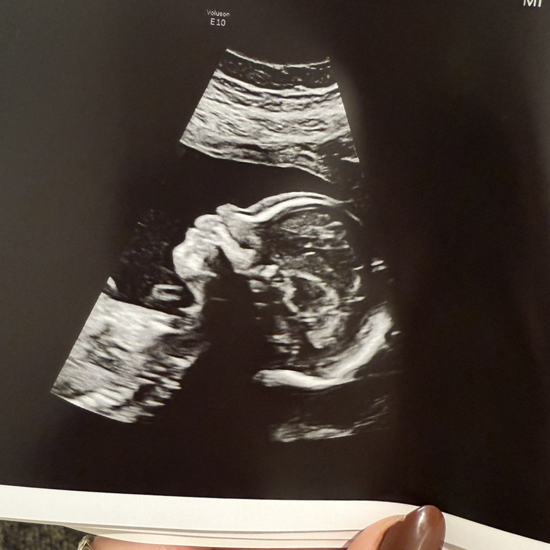 Photo shared by Toni for their Babylist baby registry.