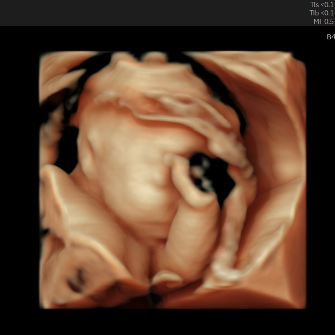 Photo shared by Catherine for their Babylist baby registry.