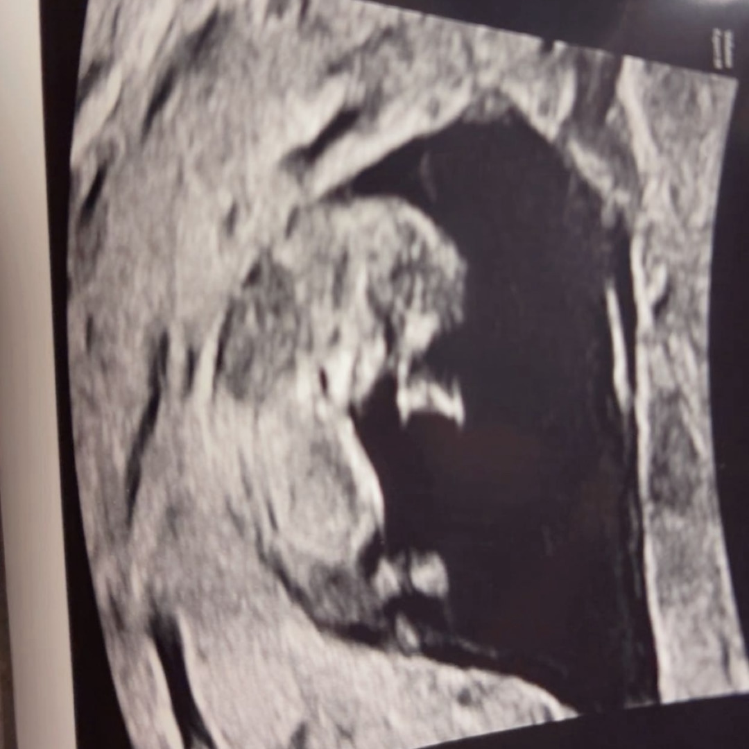 Photo shared by Stephanie for their Babylist baby registry.
