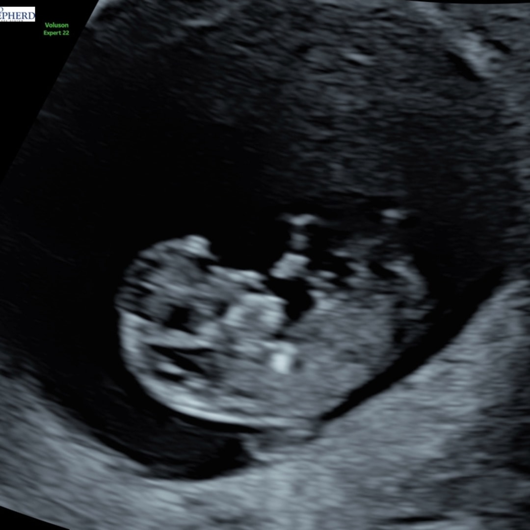 Photo shared by Addie for their Babylist baby registry.