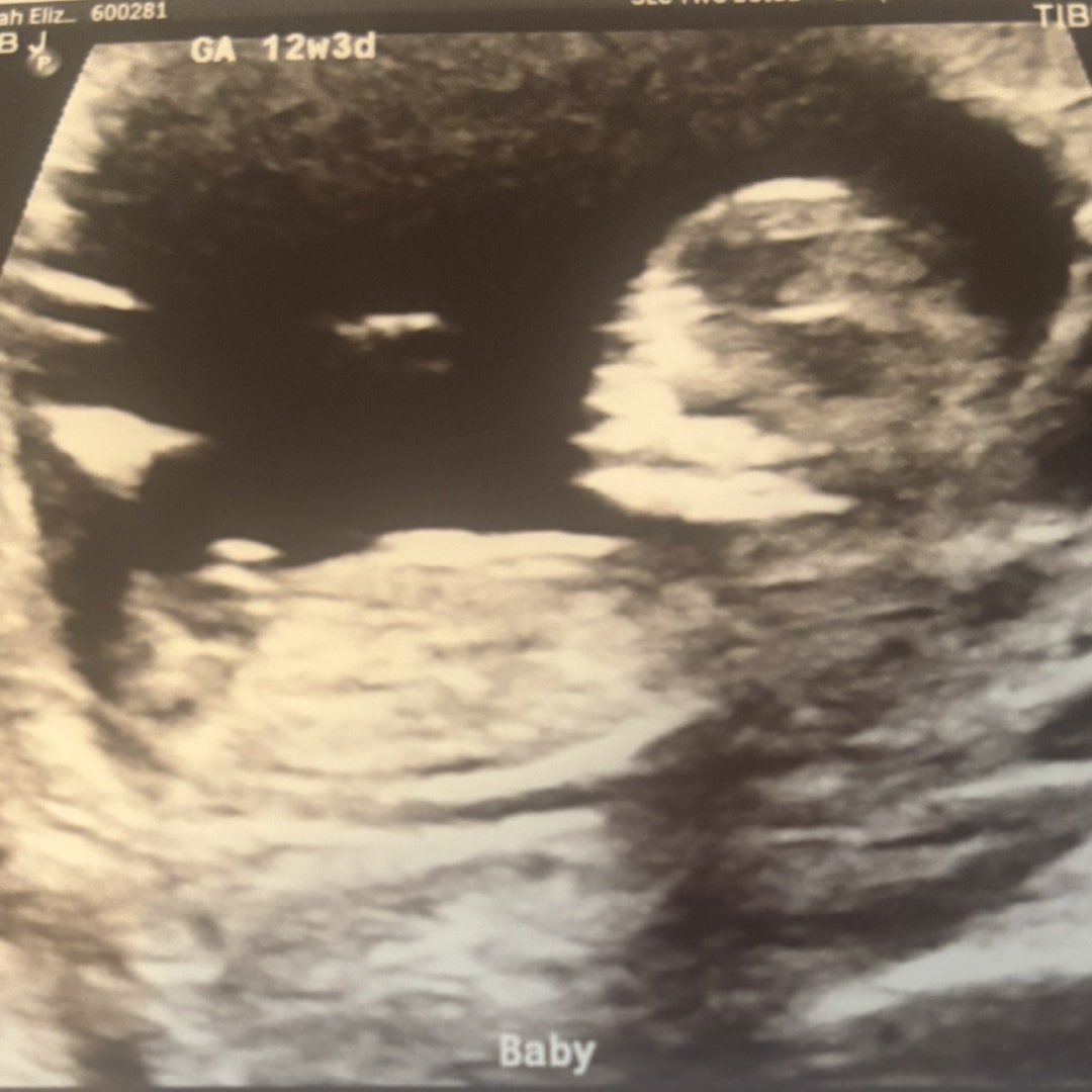 Photo shared by Sarah for their Babylist baby registry.