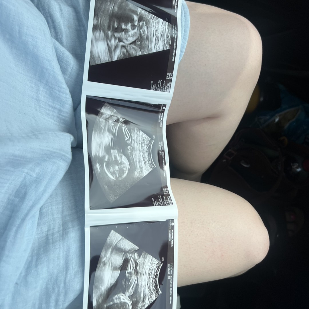 Photo shared by Josh + Aly for their Babylist baby registry.