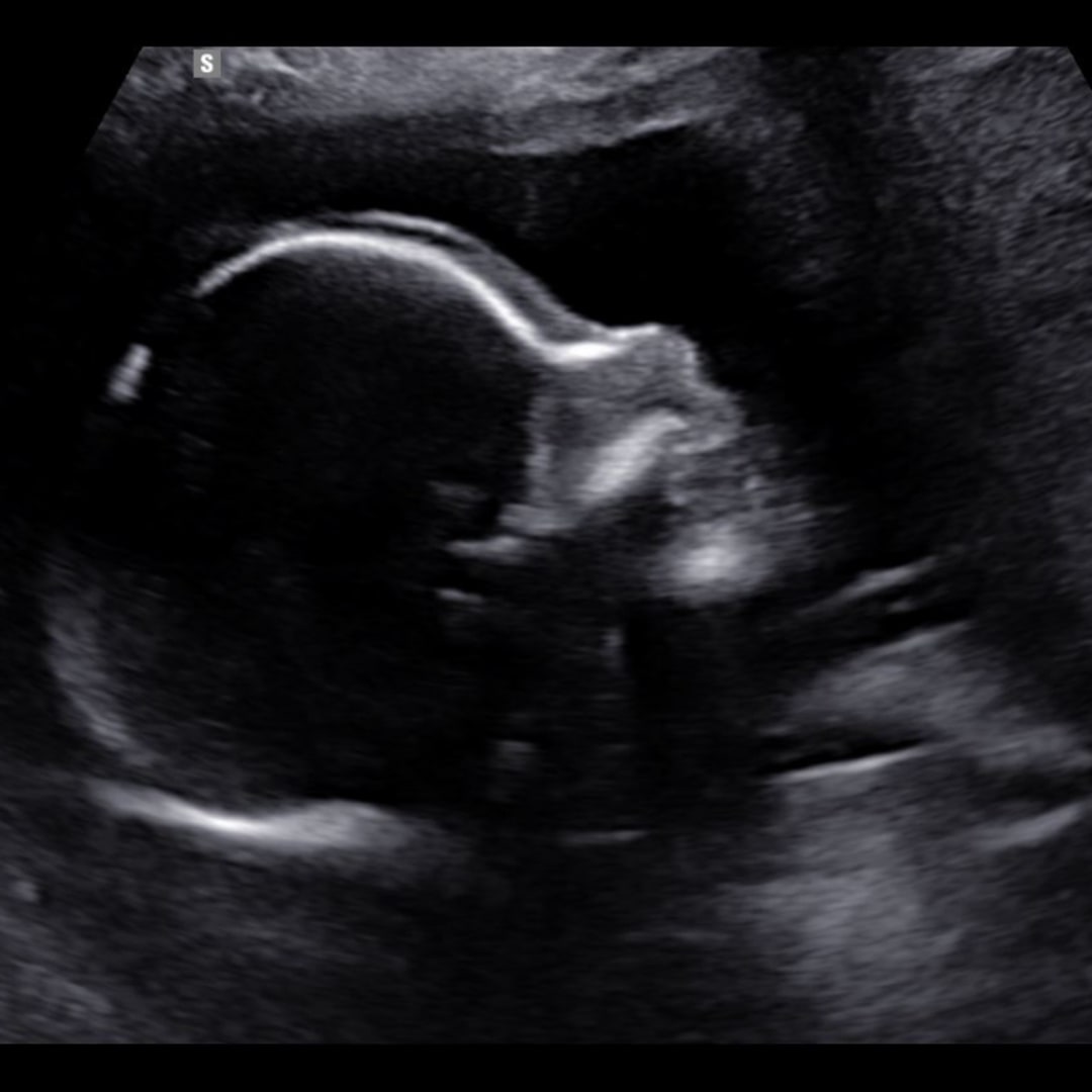 Photo shared by Kenia for their Babylist baby registry.