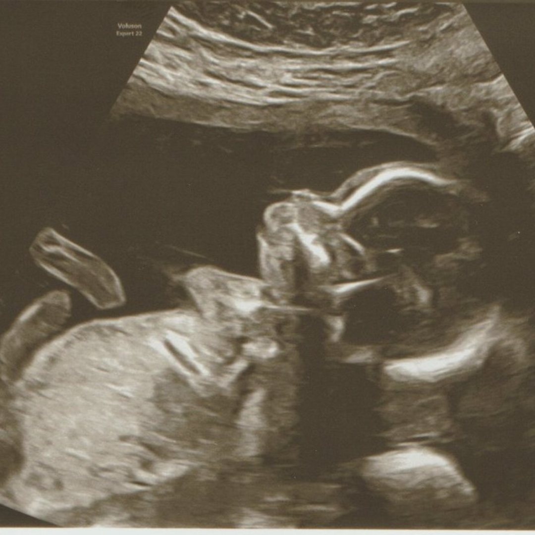 Photo shared by Jan for their Babylist baby registry.