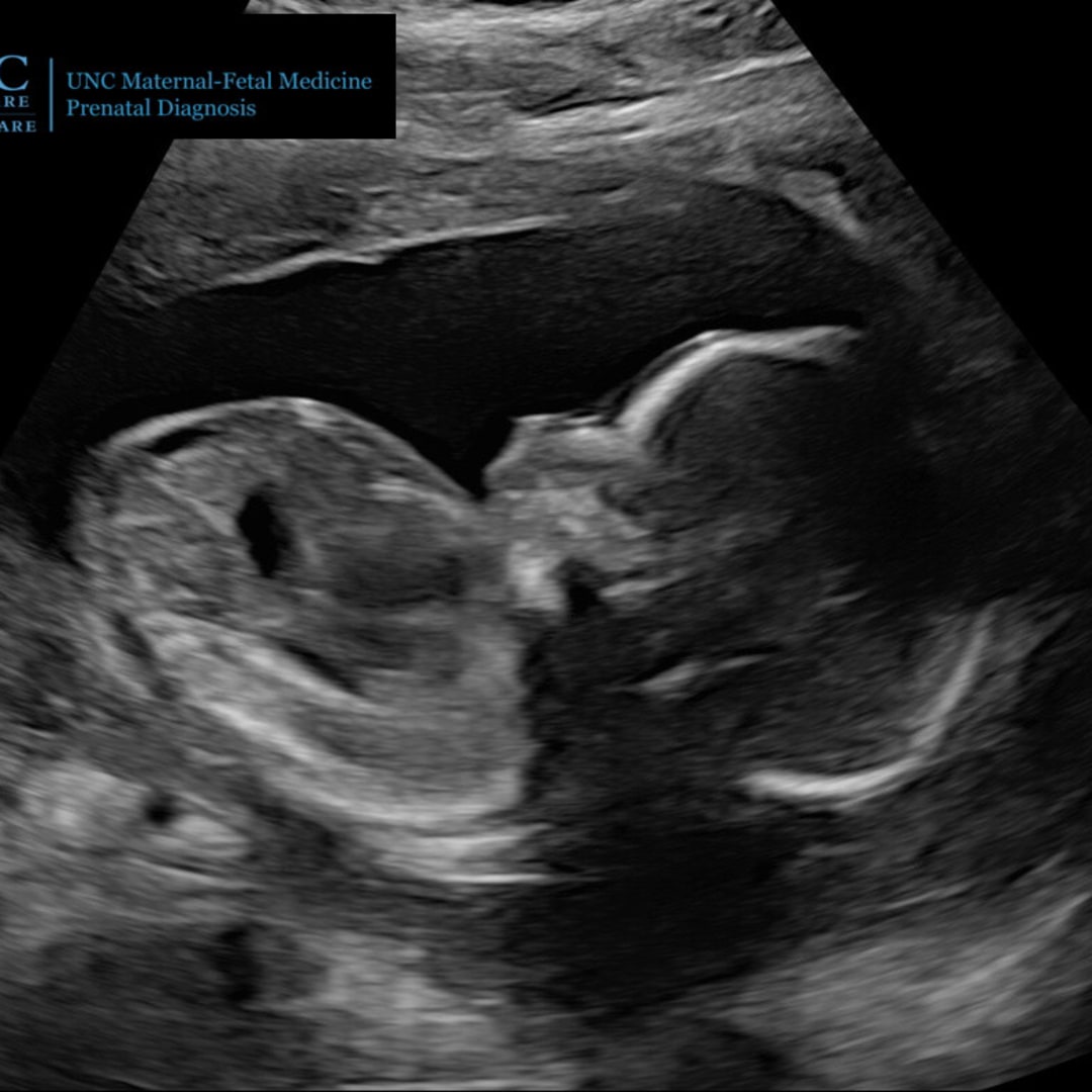 Photo shared by Ashley for their Babylist baby registry.