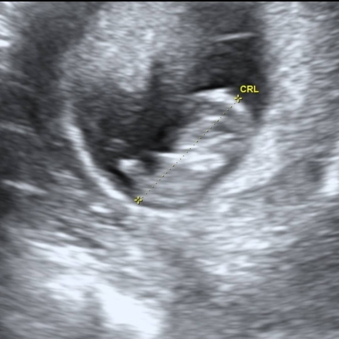 Photo shared by McKinley for their Babylist baby registry.
