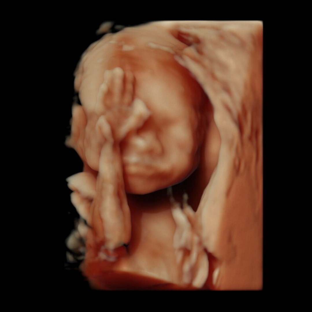 Photo shared by Annabeth for their Babylist baby registry.