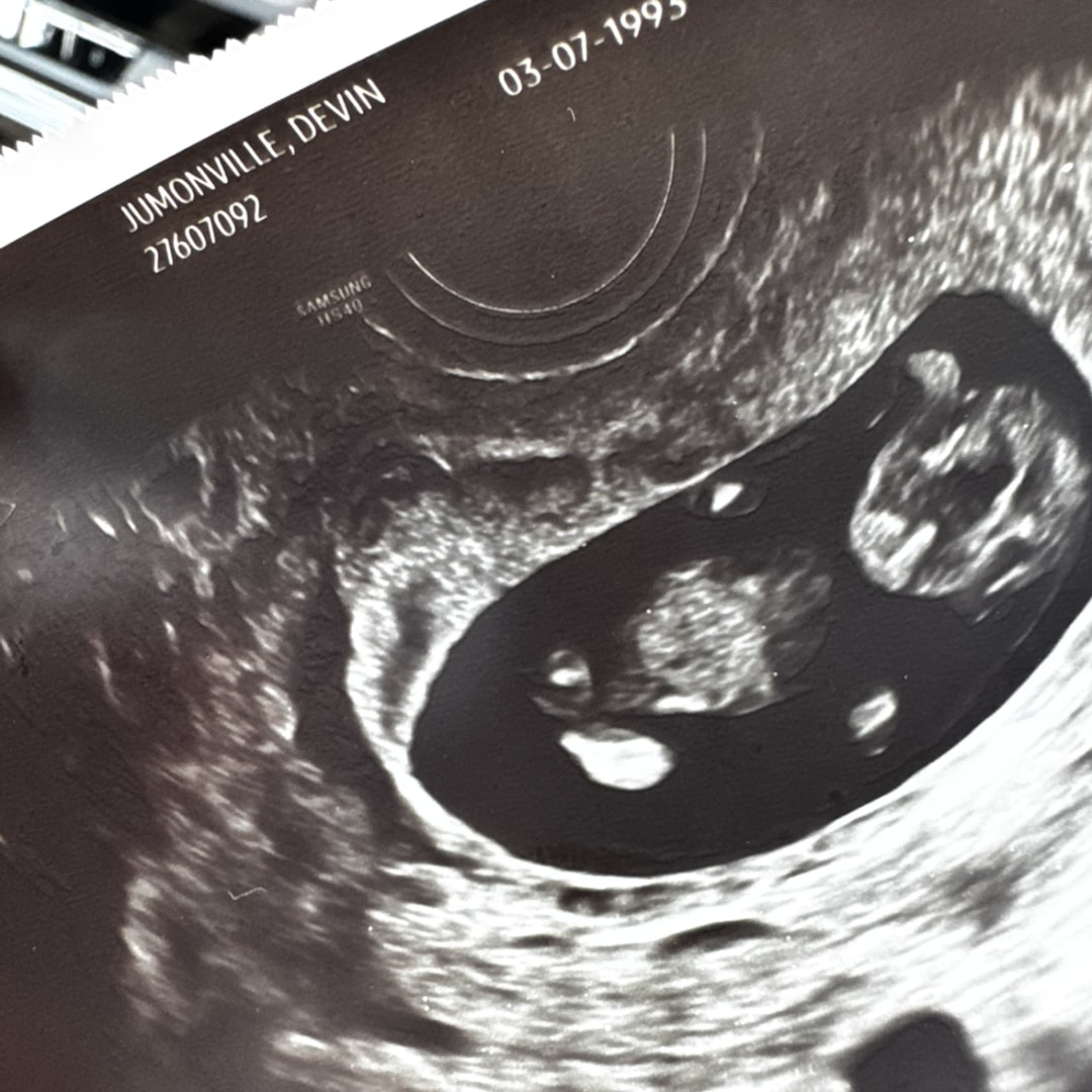 Photo shared by Devin for their Babylist baby registry.