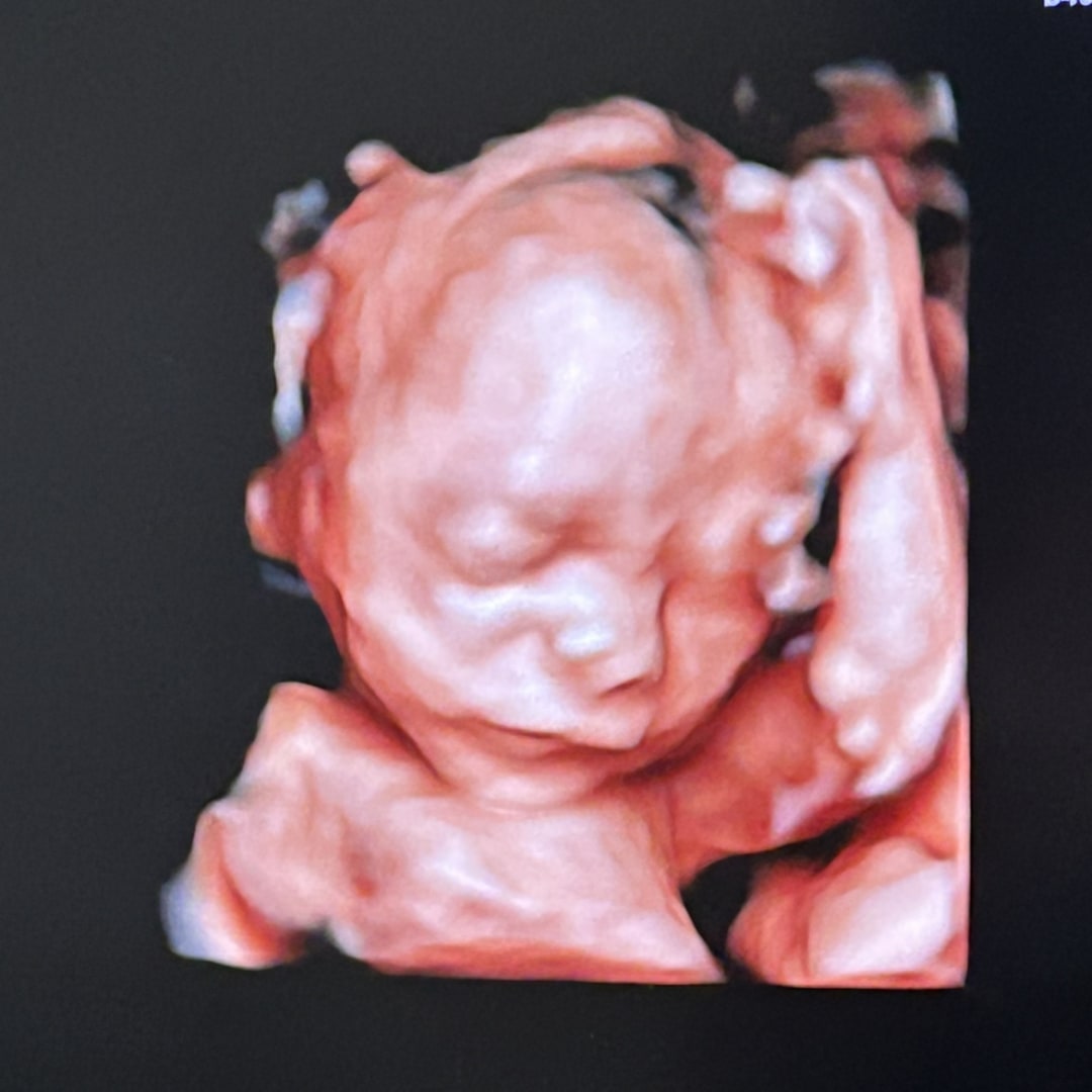 Photo shared by Jennifer for their Babylist baby registry.
