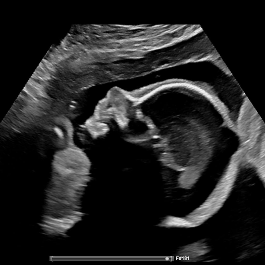 Photo shared by Amanda for their Babylist baby registry.