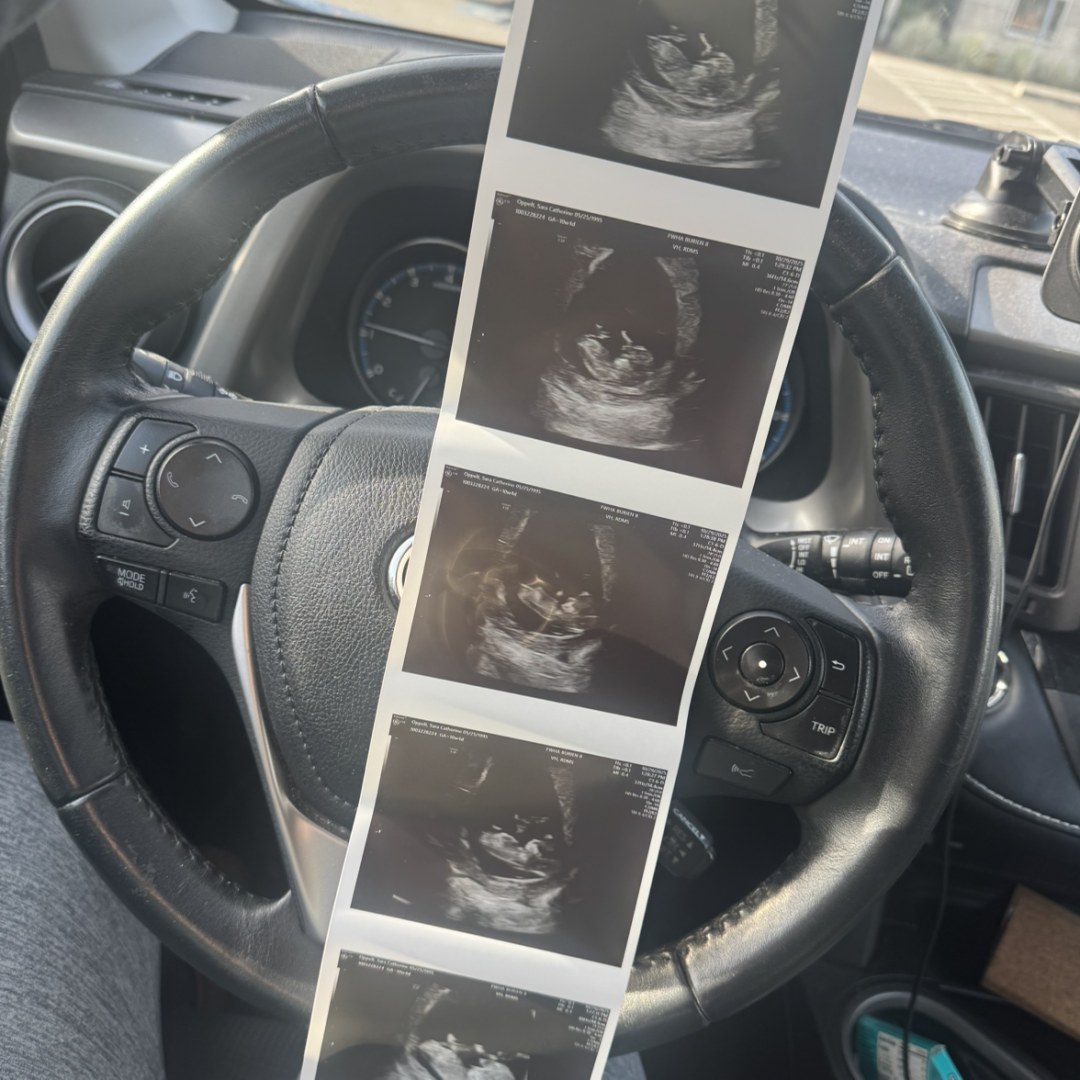 Photo shared by Sara for their Babylist baby registry.