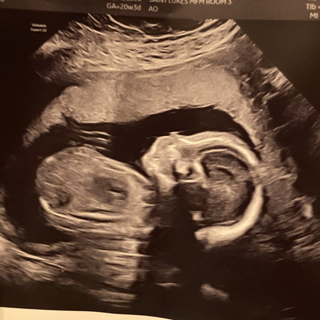 Photo shared by Dia for their Babylist baby registry.