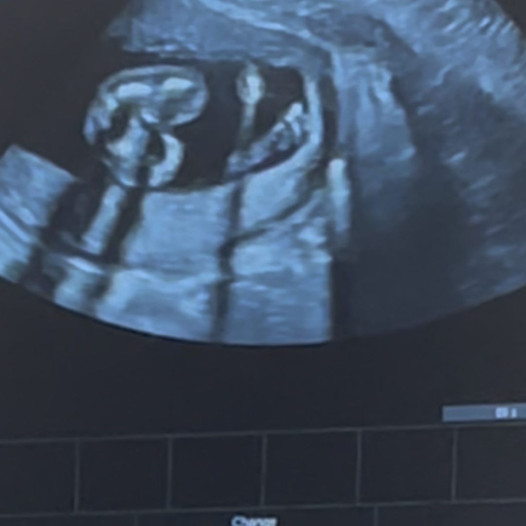 Photo shared by Kbrianey for their Babylist baby registry.