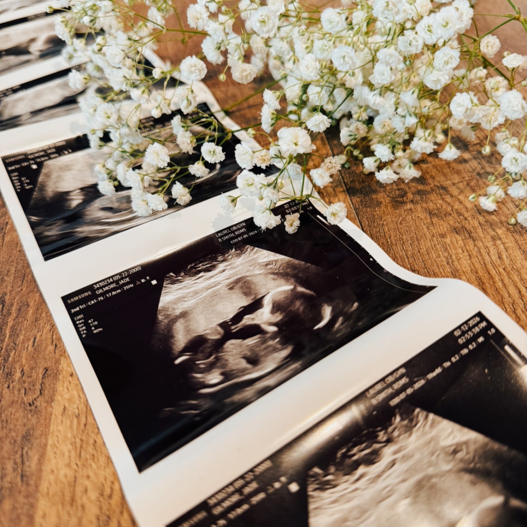 Photo shared by Jade for their Babylist baby registry.