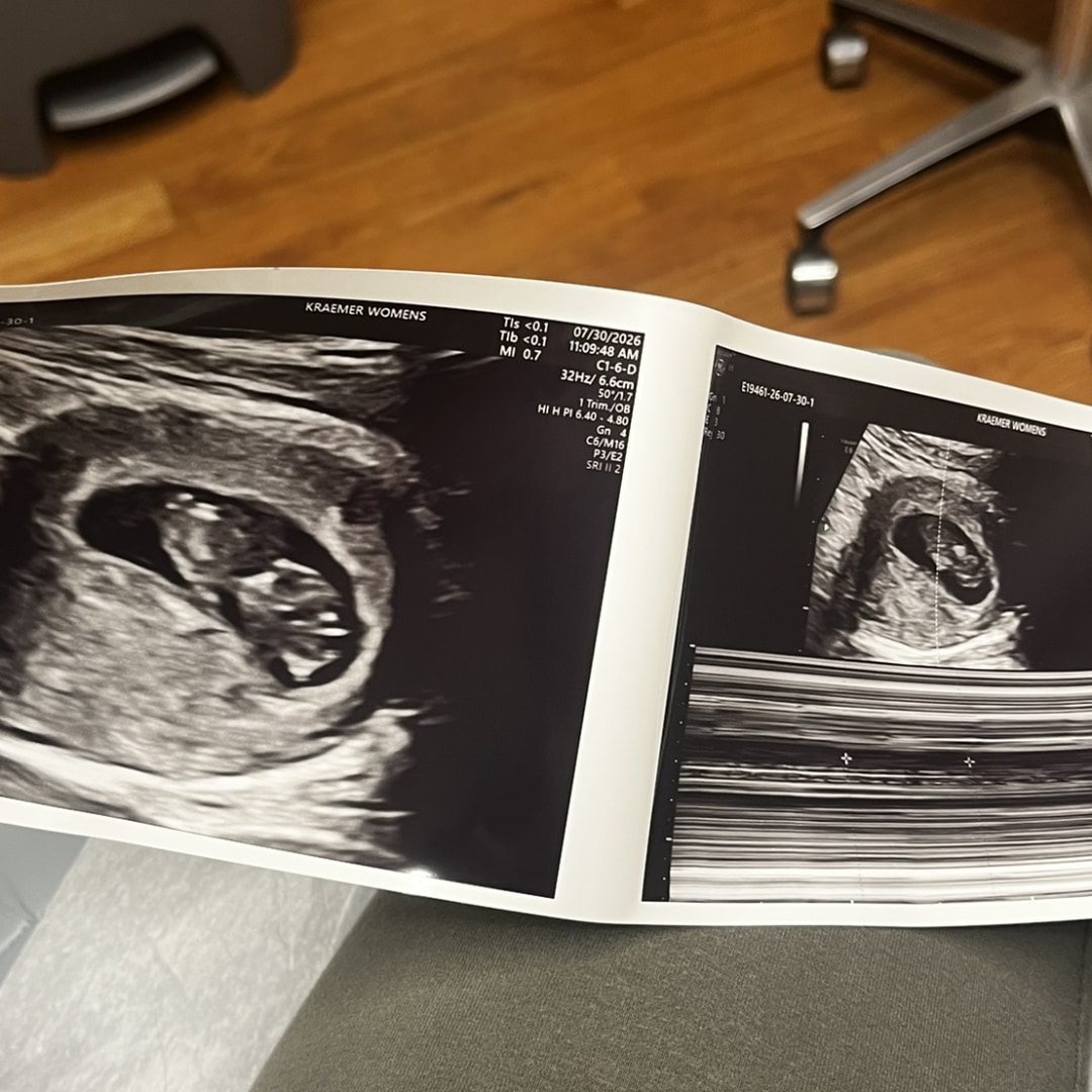 Photo shared by McKenzie for their Babylist baby registry.