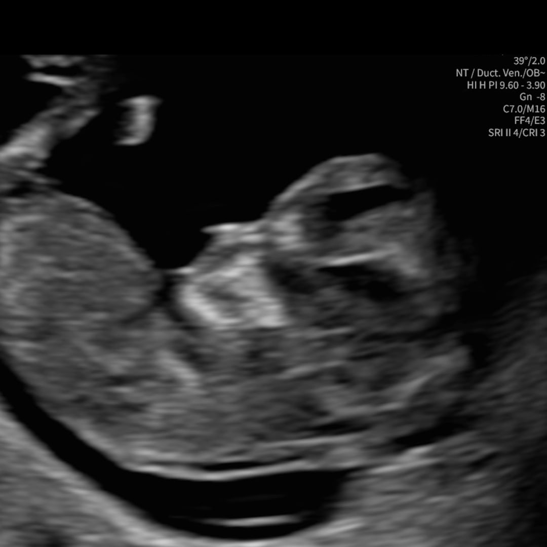 Photo shared by Altonese for their Babylist baby registry.