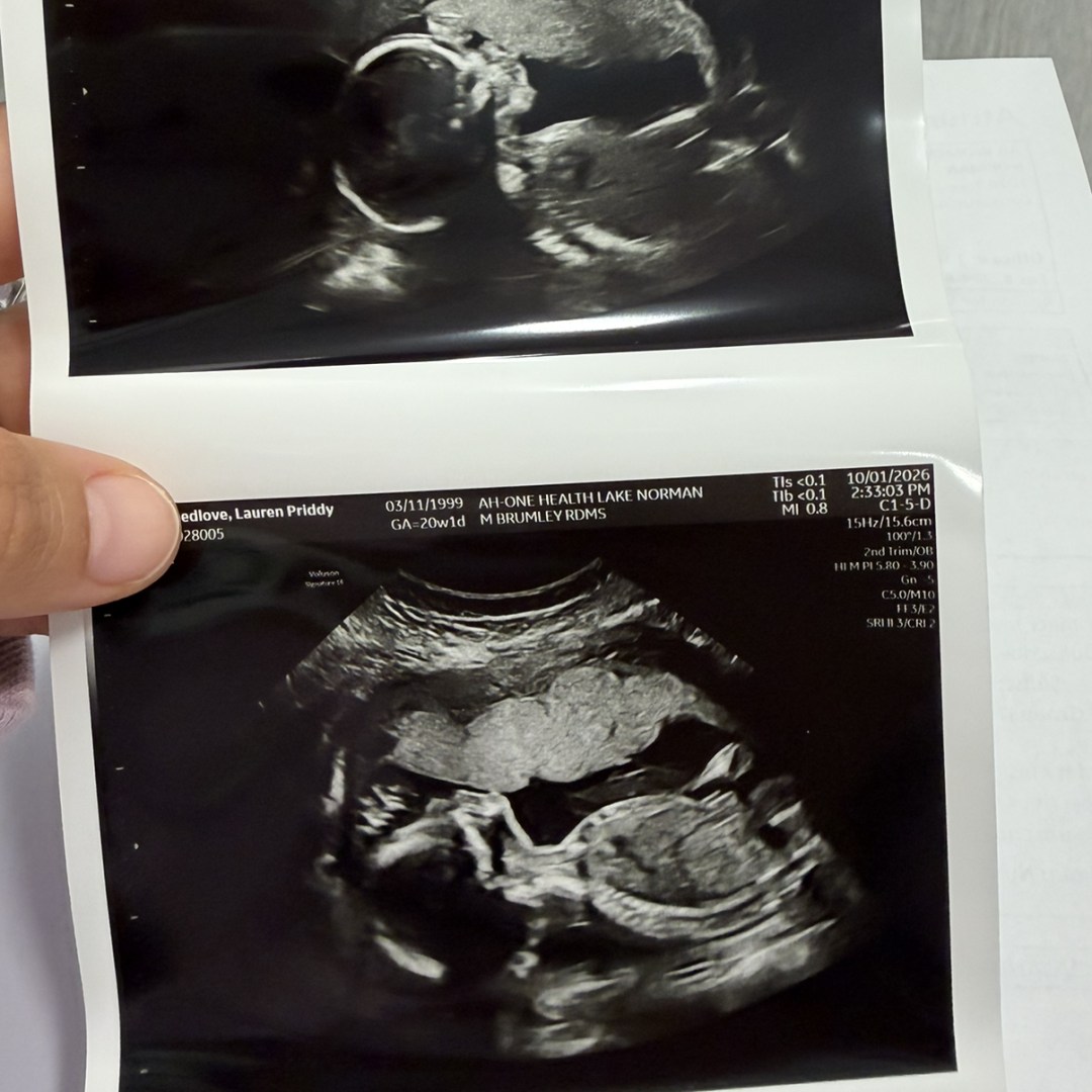 Photo shared by Lauren for their Babylist baby registry.