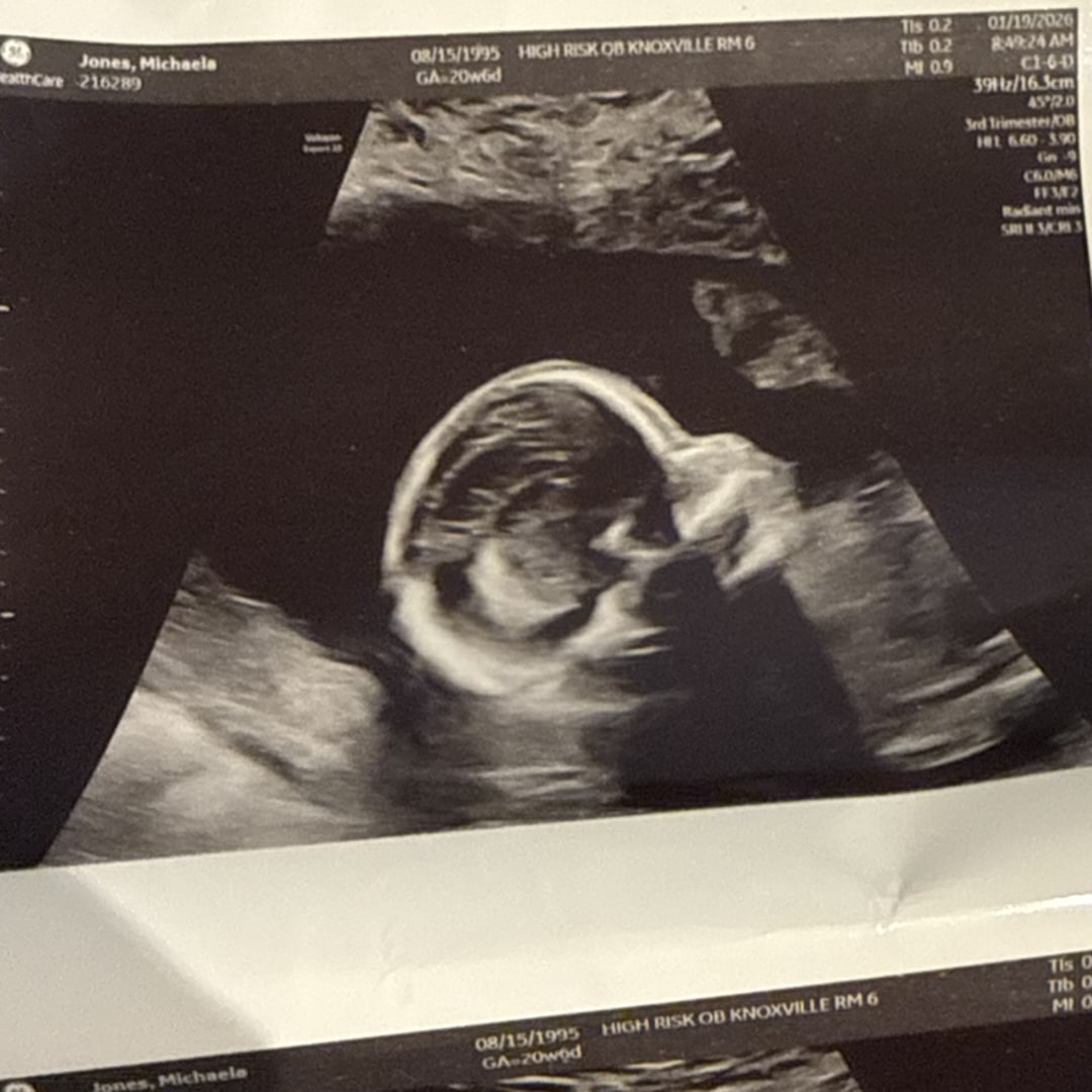 Photo shared by Michaela for their Babylist baby registry.