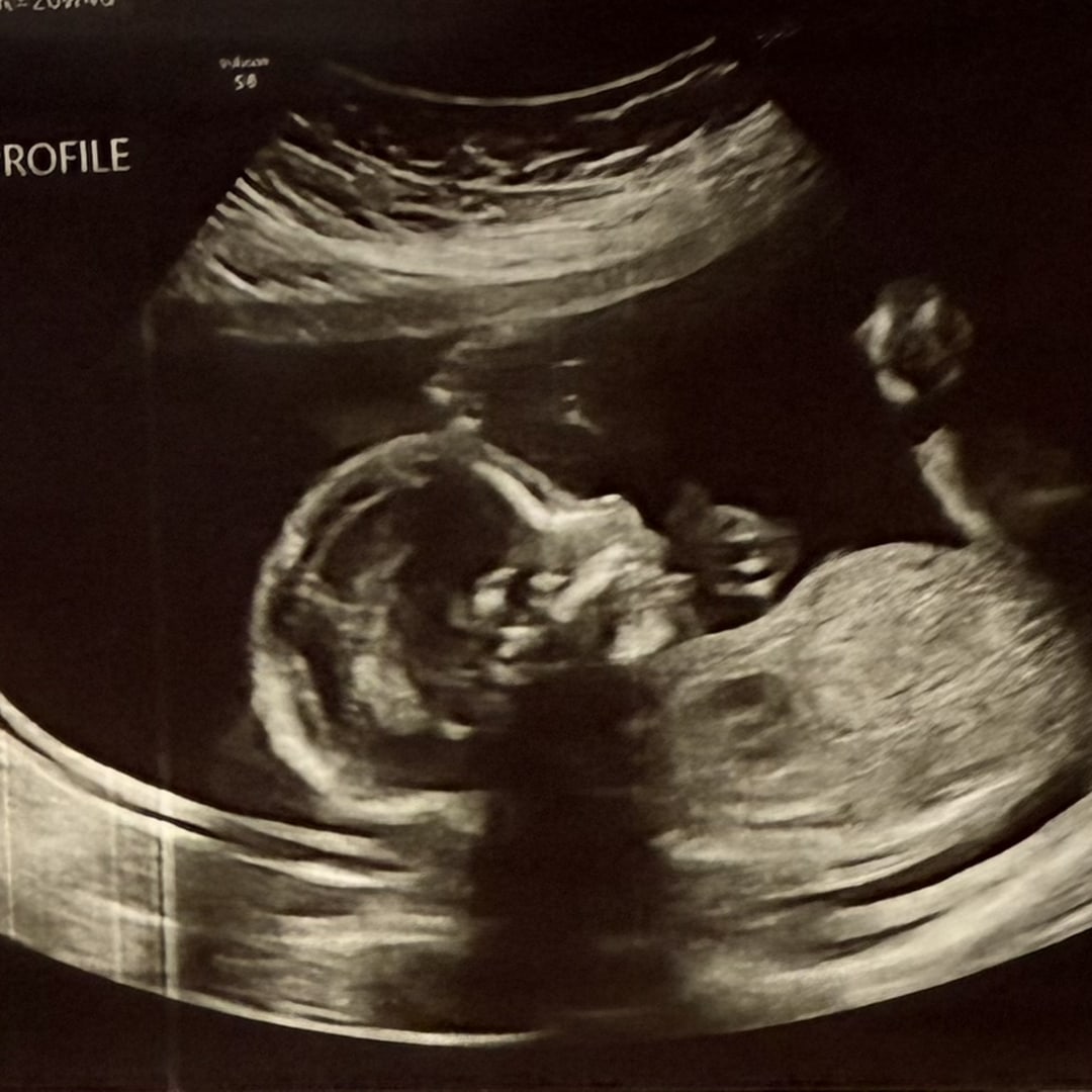 Photo shared by Isabela for their Babylist baby registry.