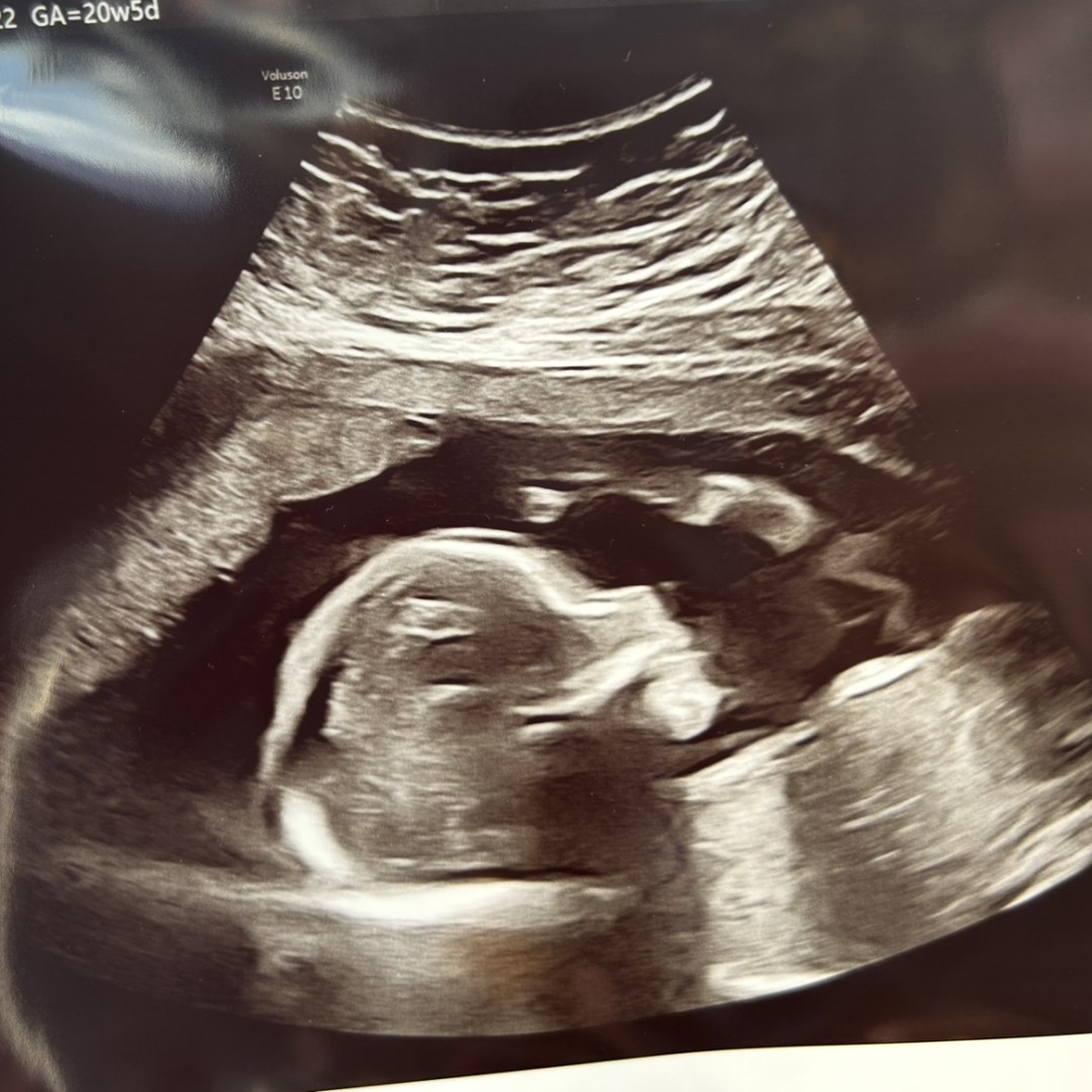 Photo shared by Emily for their Babylist baby registry.