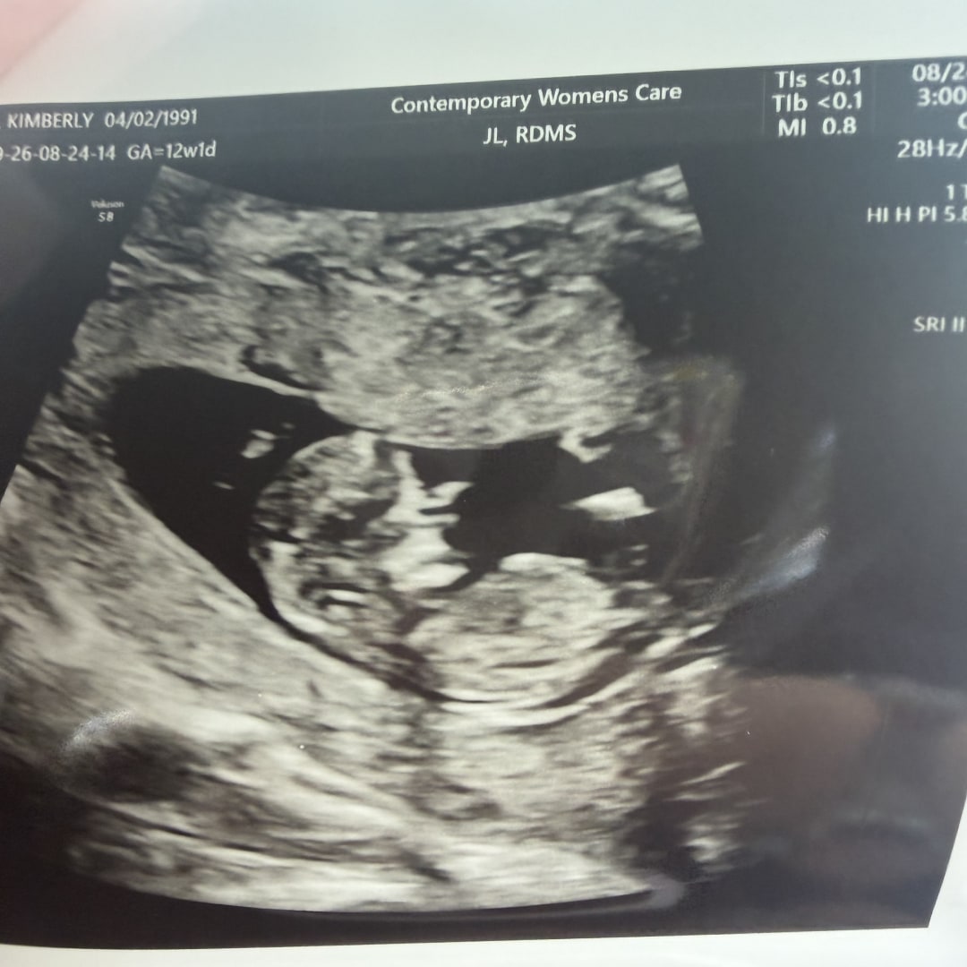 Photo shared by Kim for their Babylist baby registry.