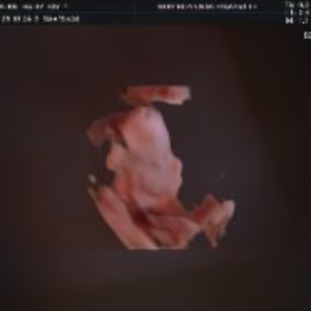 Photo shared by Haley-Kay for their Babylist baby registry.