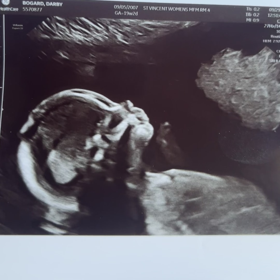 Photo shared by Darby for their Babylist baby registry.