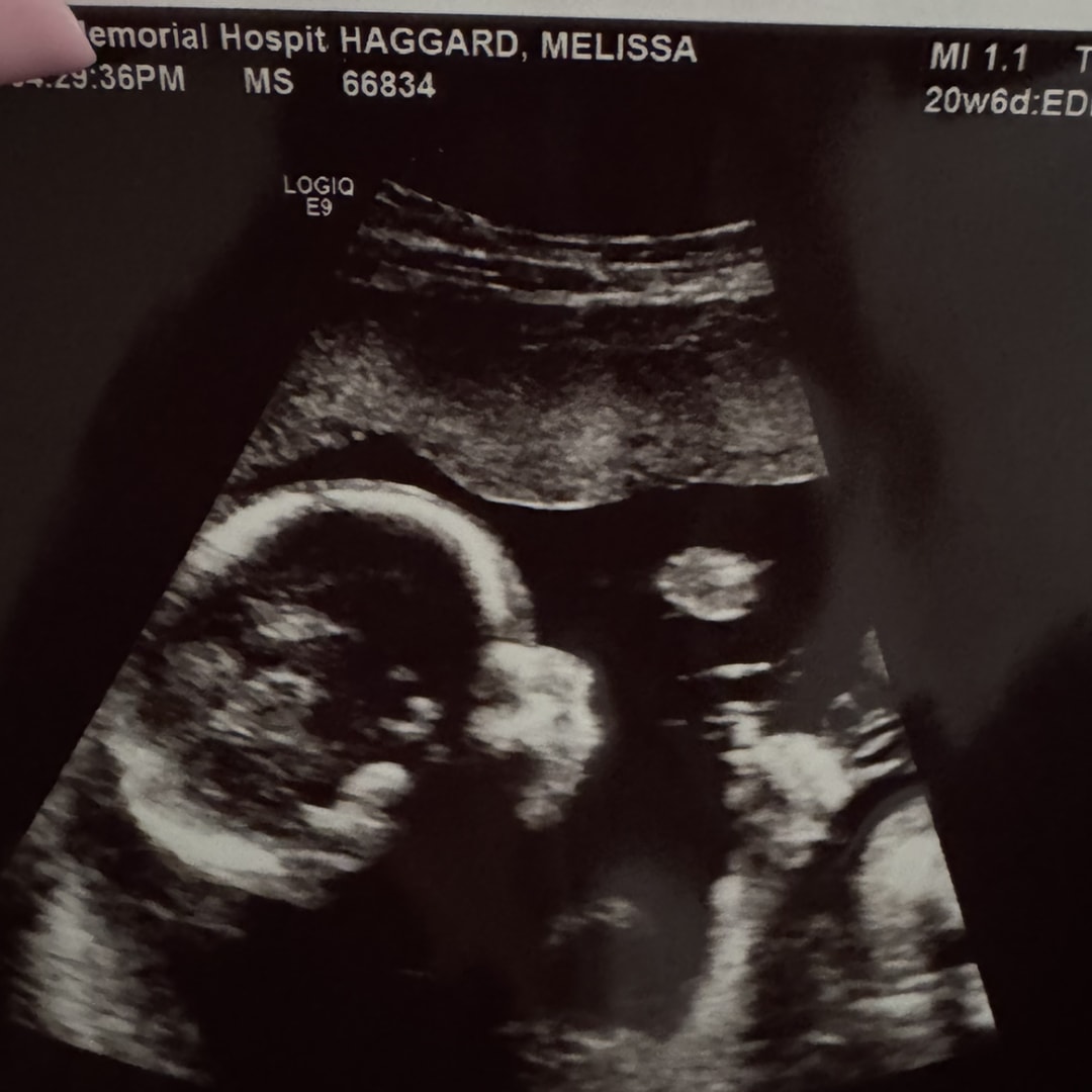 Photo shared by Melissa for their Babylist baby registry.