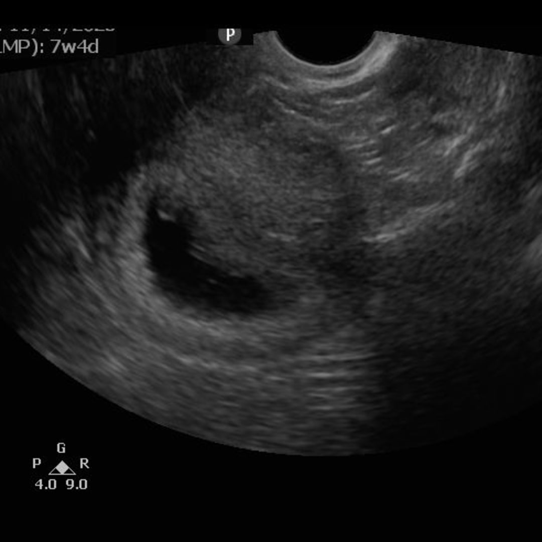 Photo shared by Ali for their Babylist baby registry.