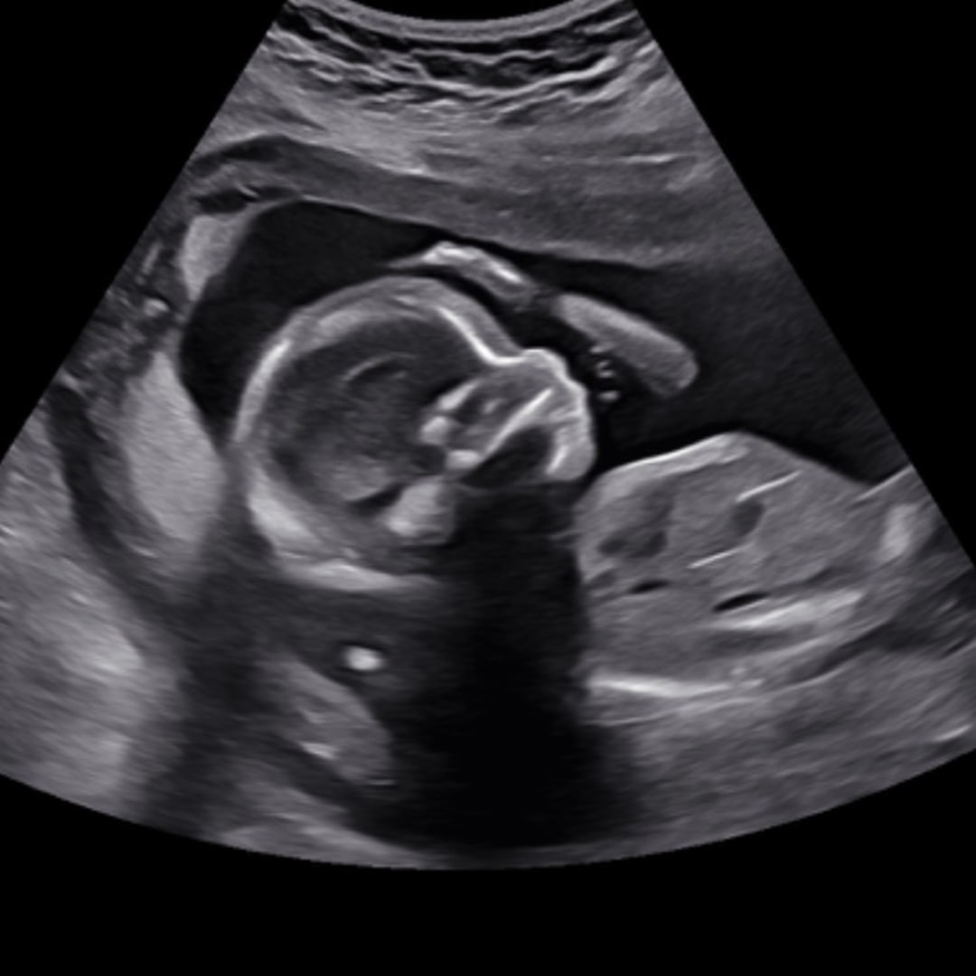 Photo shared by Chyanne for their Babylist baby registry.