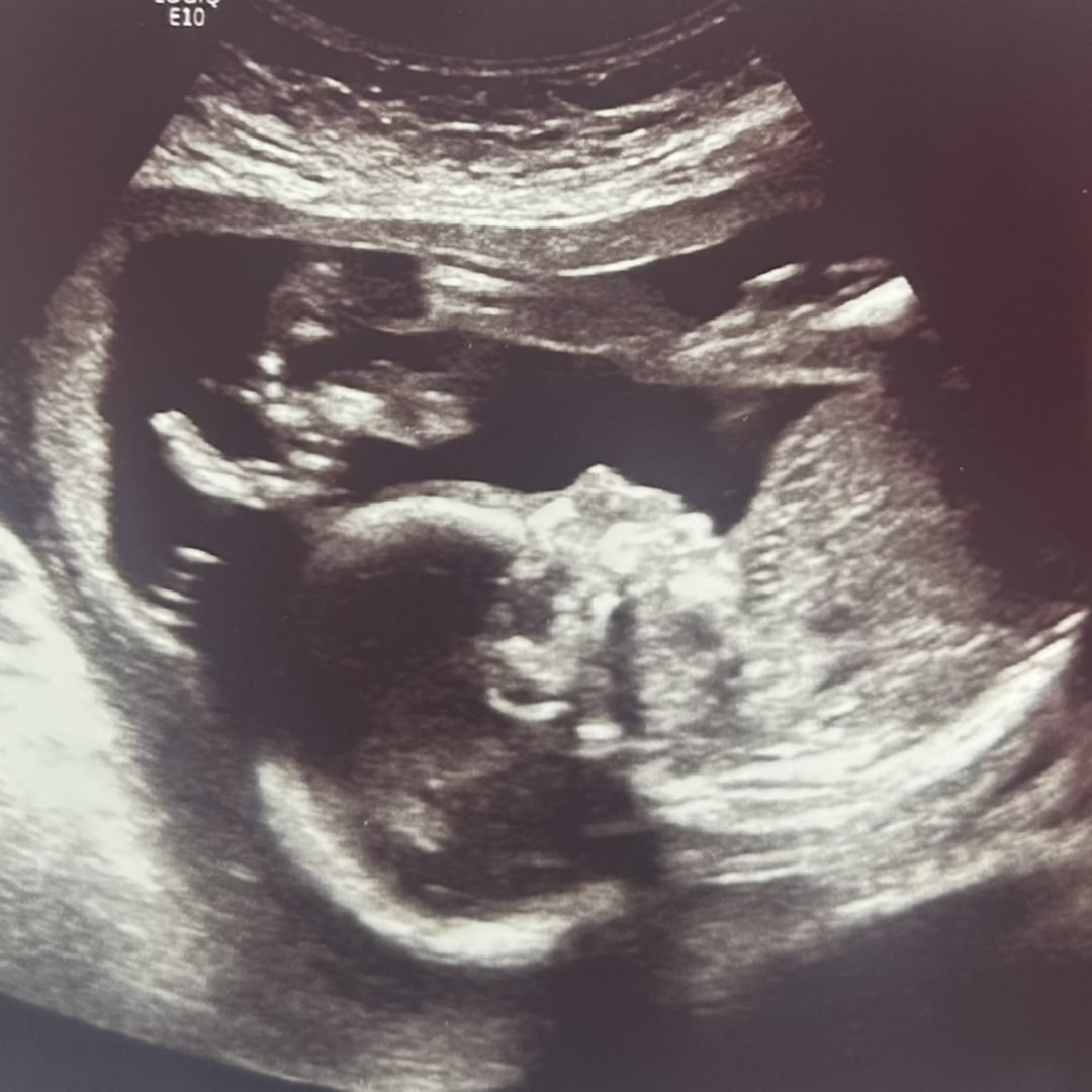 Photo shared by Nadia for their Babylist baby registry.
