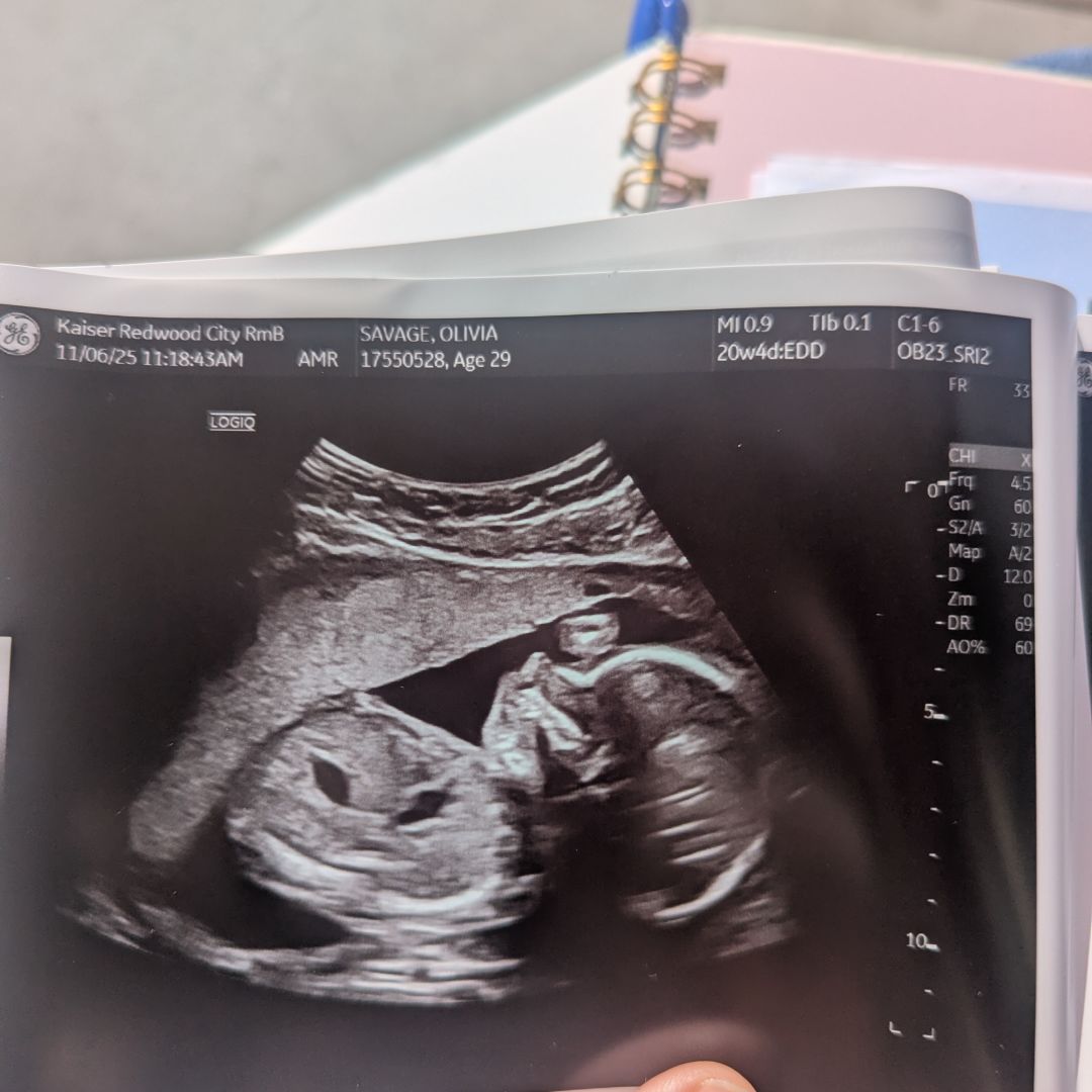 Photo shared by Olivia for their Babylist baby registry.