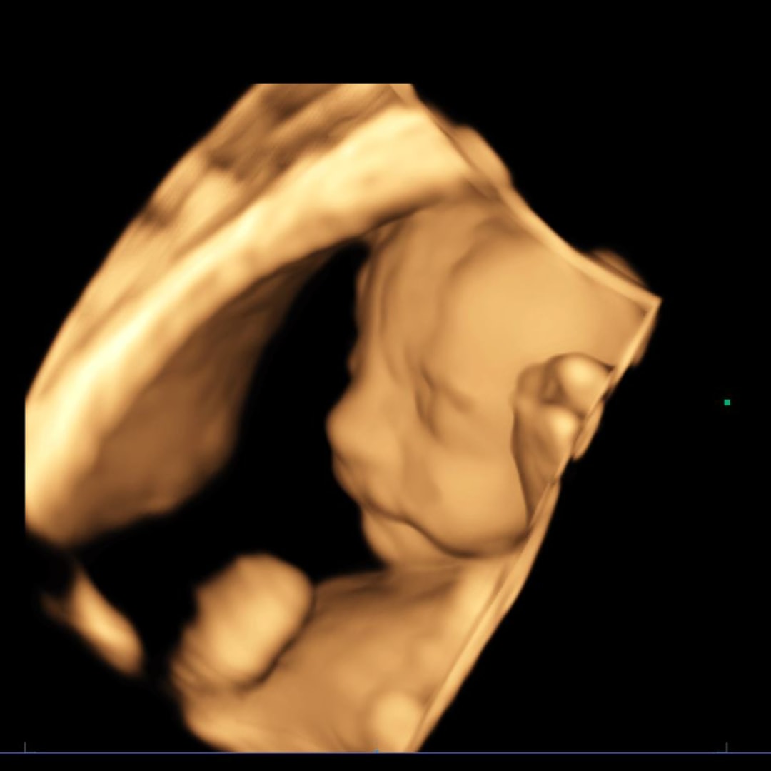 Photo shared by Elizabeth for their Babylist baby registry.