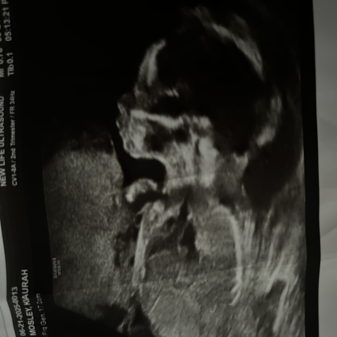 Photo shared by Kiaurah for their Babylist baby registry.