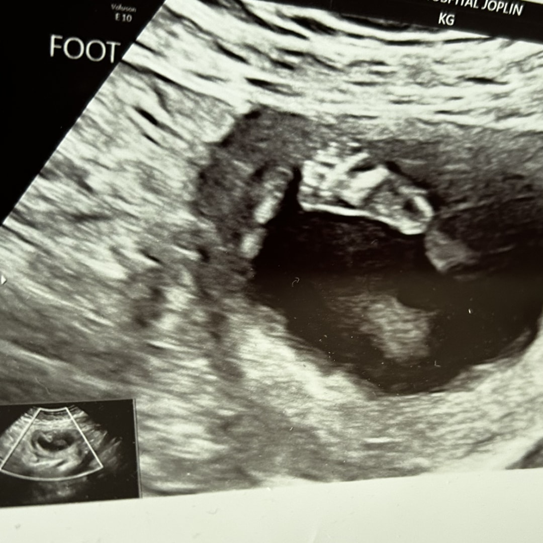 Photo shared by Rachel for their Babylist baby registry.
