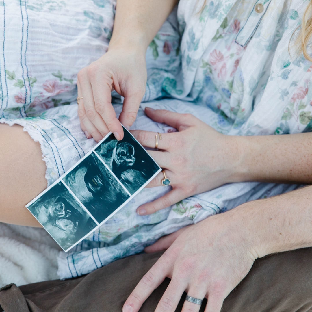 Photo shared by McKenzie for their Babylist baby registry.