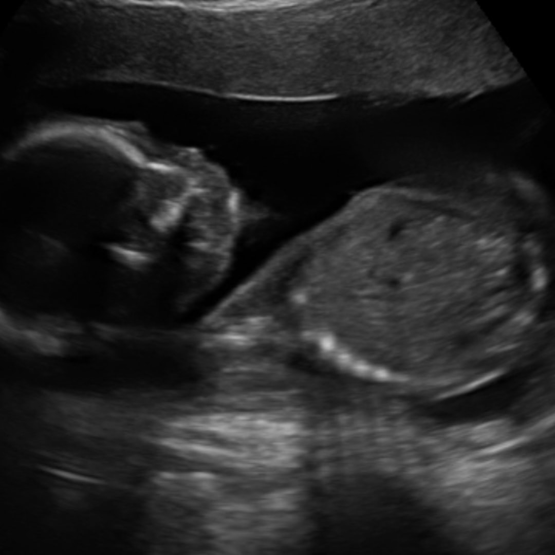 Photo shared by Lily for their Babylist baby registry.