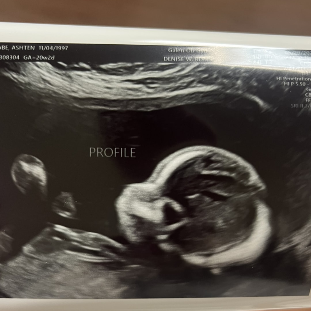 Photo shared by Ashten for their Babylist baby registry.