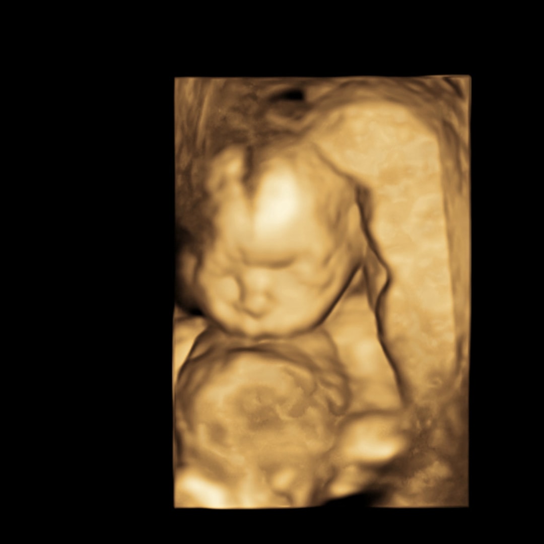 Photo shared by Shannon for their Babylist baby registry.