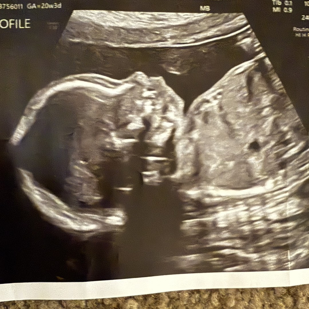 Photo shared by Citlalli for their Babylist baby registry.