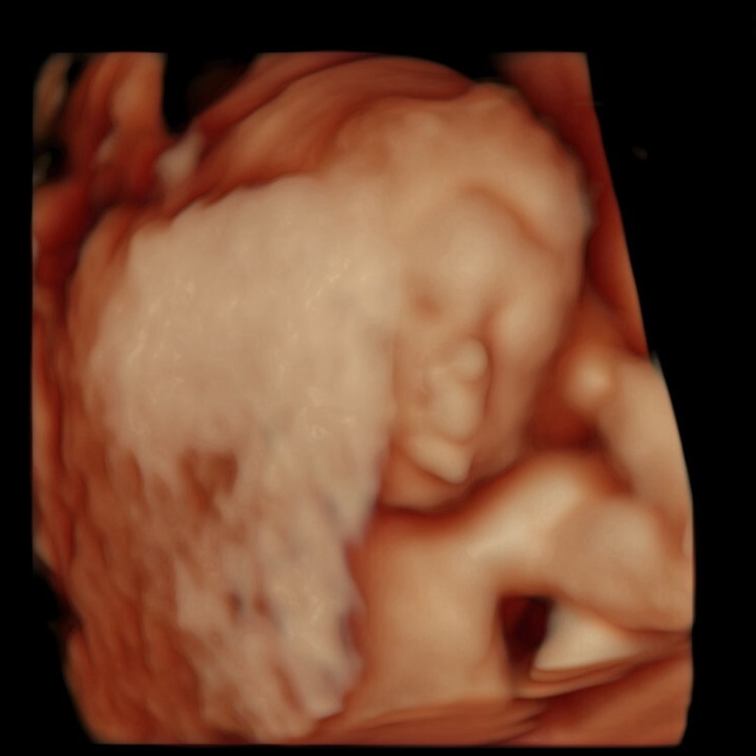 Photo shared by Kamryn for their Babylist baby registry.