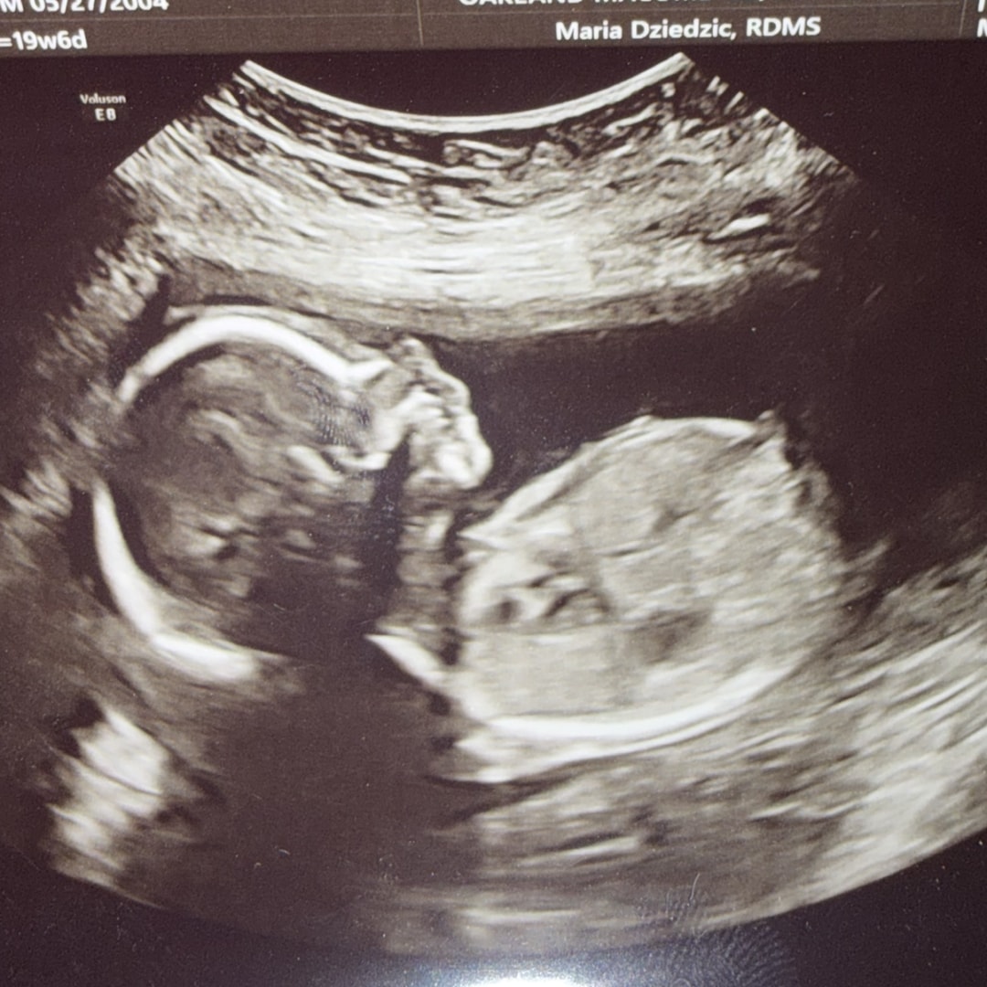 Photo shared by Leah for their Babylist baby registry.