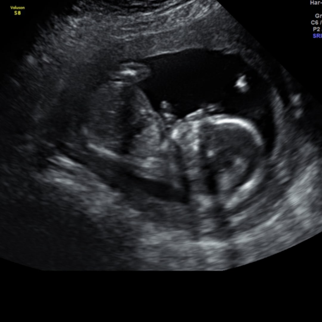 Photo shared by Ambrea for their Babylist baby registry.