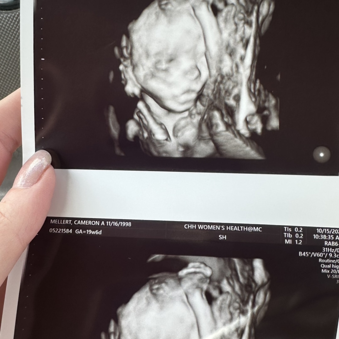 Photo shared by Cameron for their Babylist baby registry.